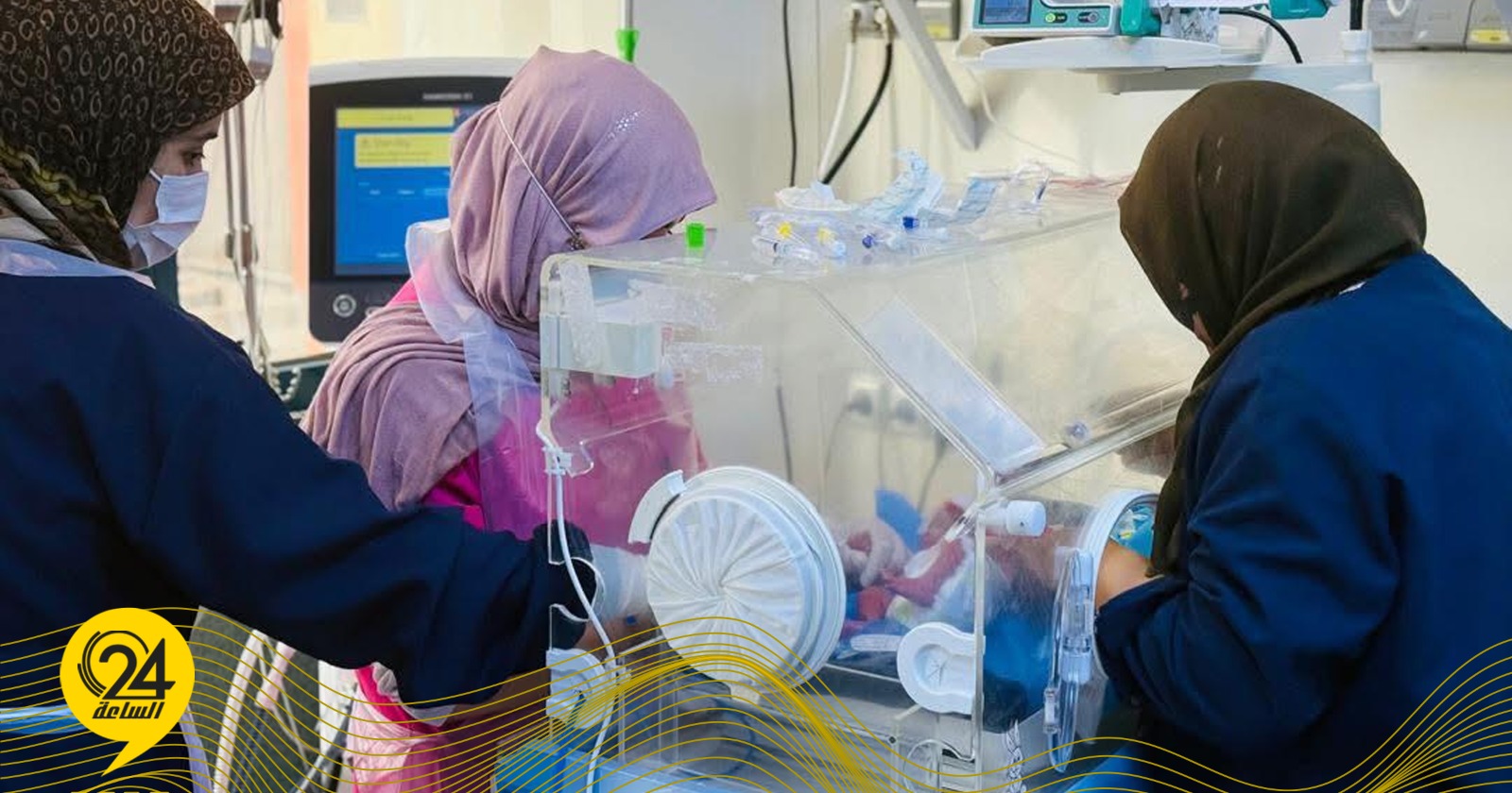 في مستشفى الجلاء.. ولادة نادرة لأربعة توائم في الشهر الثامن